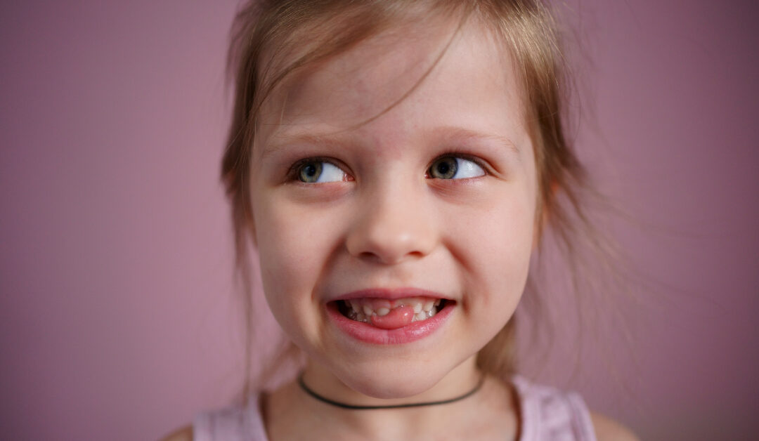 Deglución atípica en niños: síntomas, causas y tratamiento